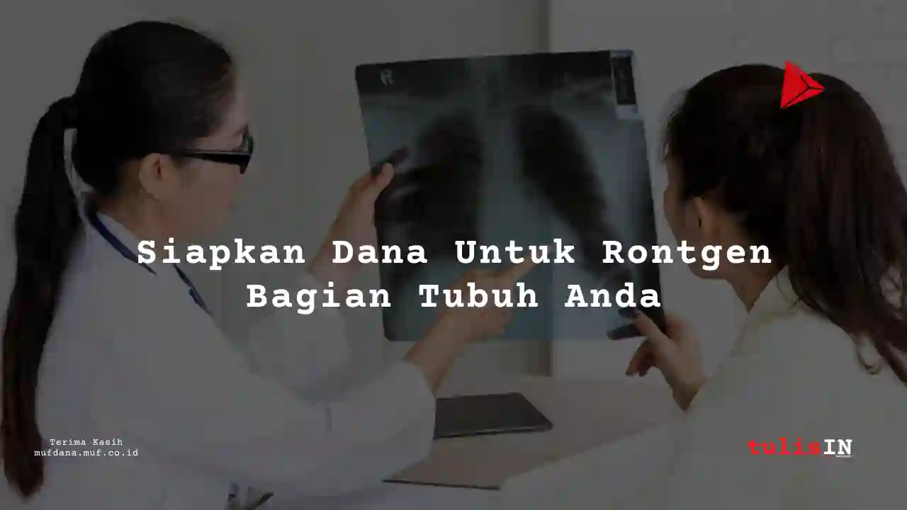 Berapa Harga Rontgen gigi  di RSU Bunda Margonda Depok?