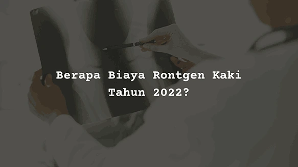Berapa Biaya Rontgen Kaki Tahun 2022?