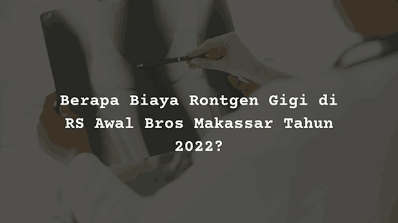 Berapa Harga Biaya Rontgen Gigi di RS Awal Bros Makassar?