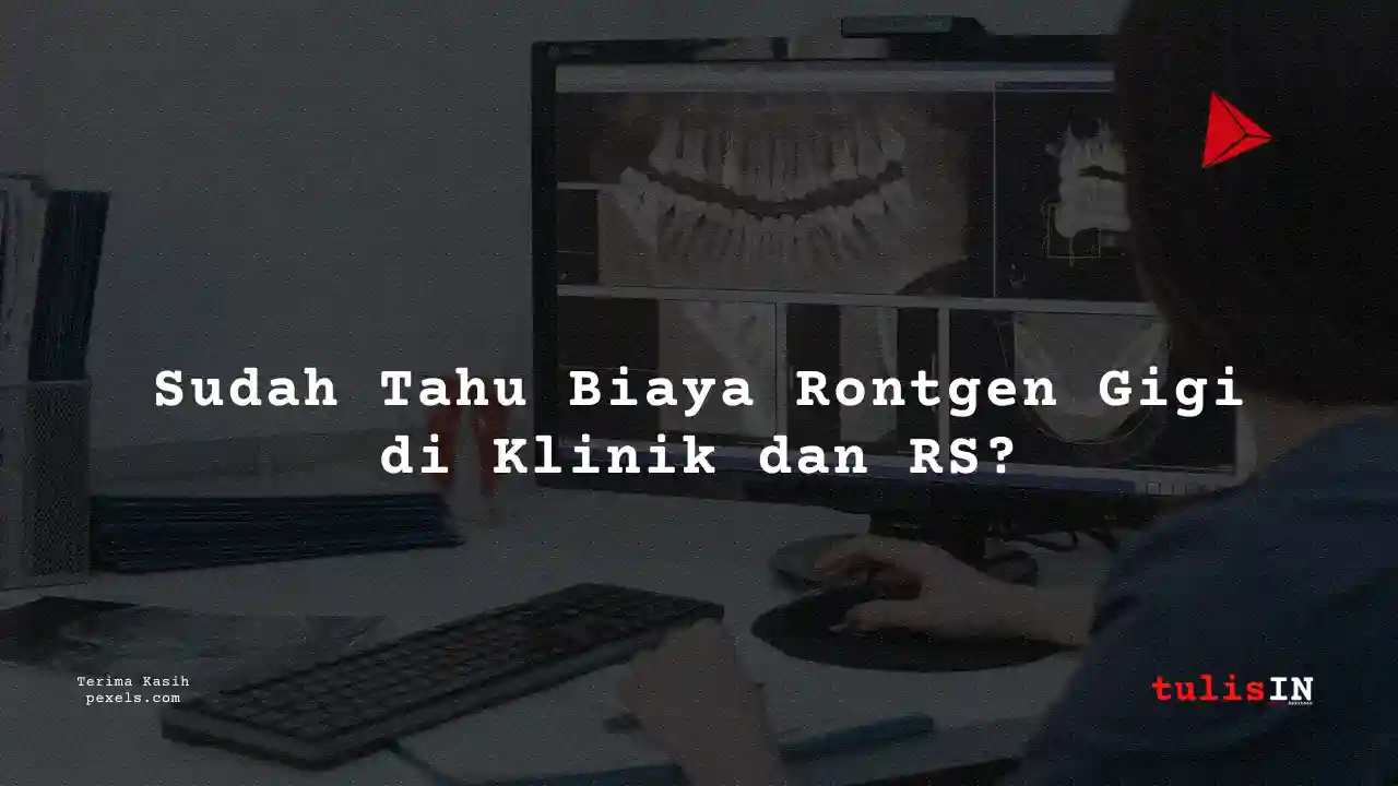 Berapa Biaya Rontgen Gigi Klinik Kimia Farma 2023?