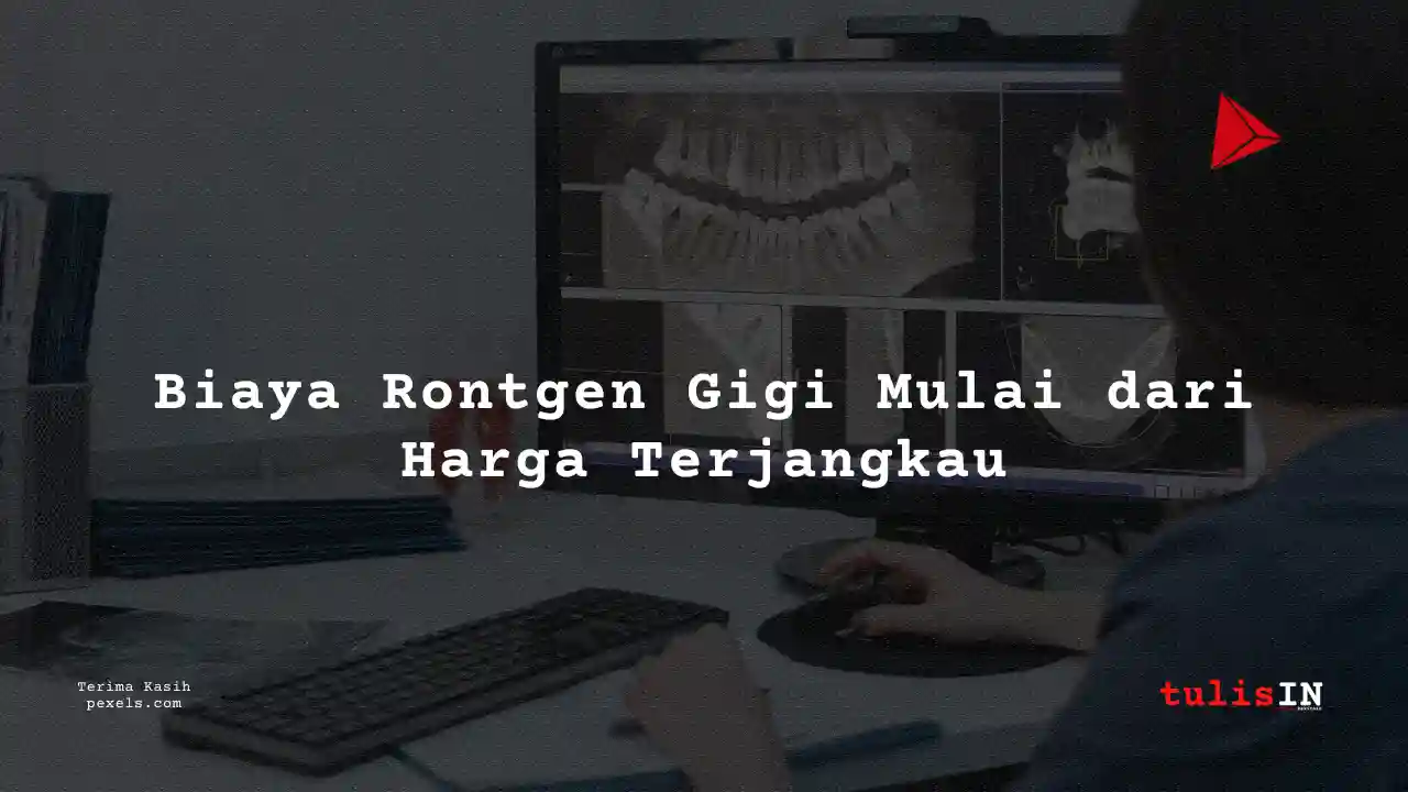 Berapa Biaya Rontgen Gigi Laboratorium Prodia 2023?