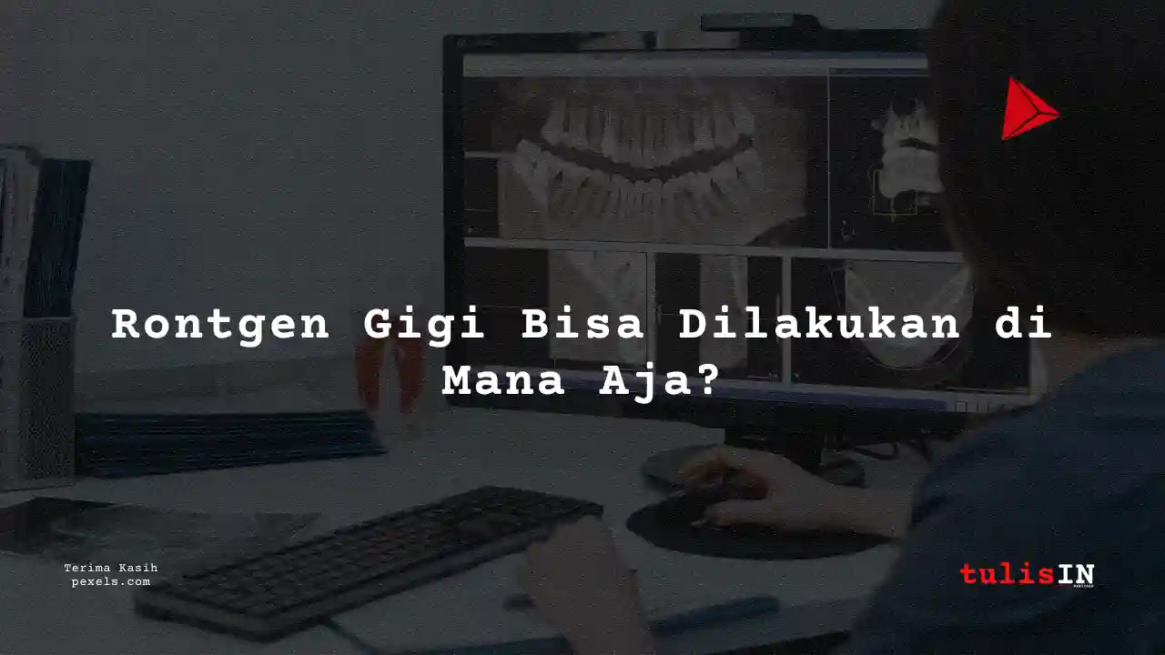 Berapa Biaya Rontgen Gigi Puskesmas 2023?