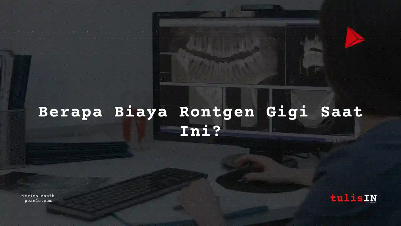 Berapa Biaya Rontgen Gigi RS EMC Pulomas 2023?