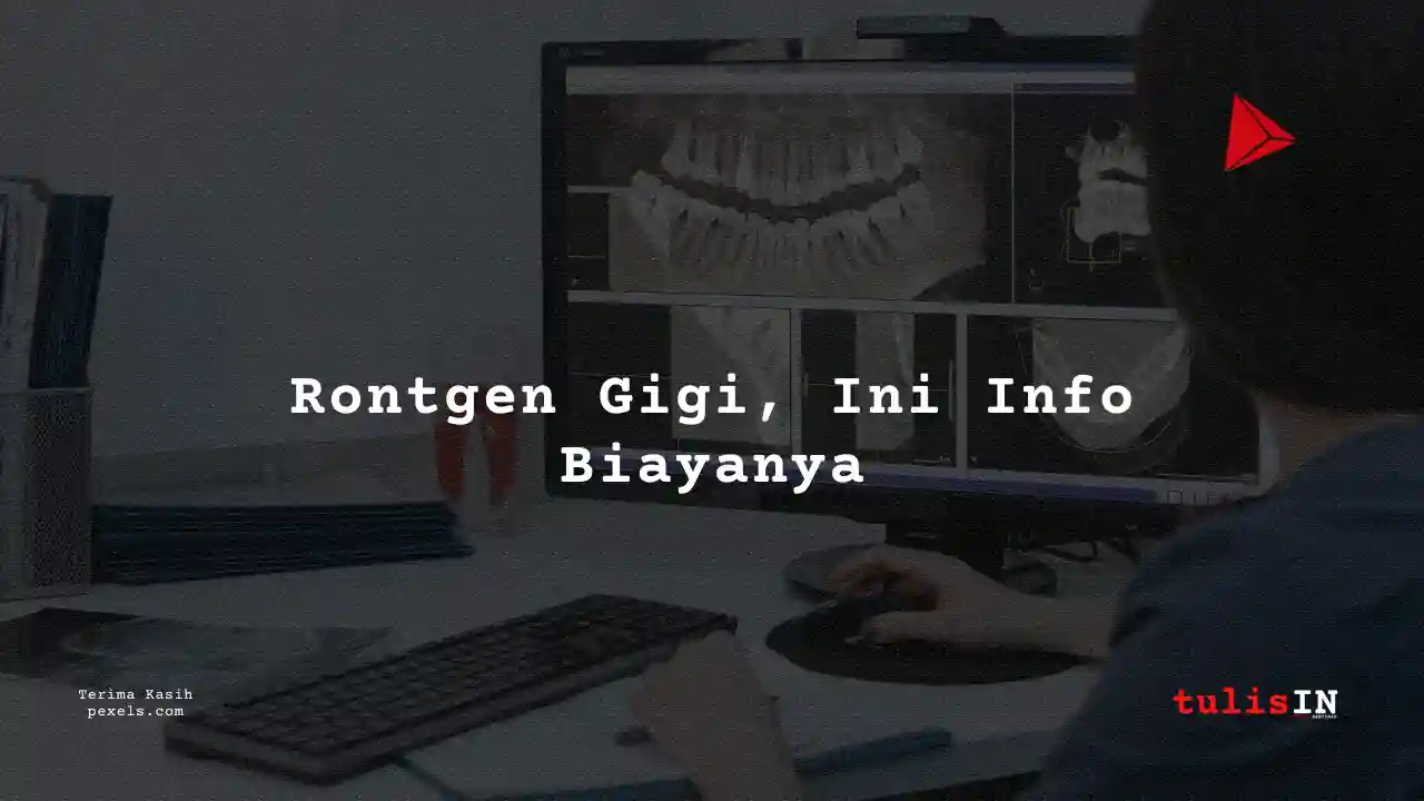 Berapa Biaya Rontgen Gigi Sima Lab 2023?
