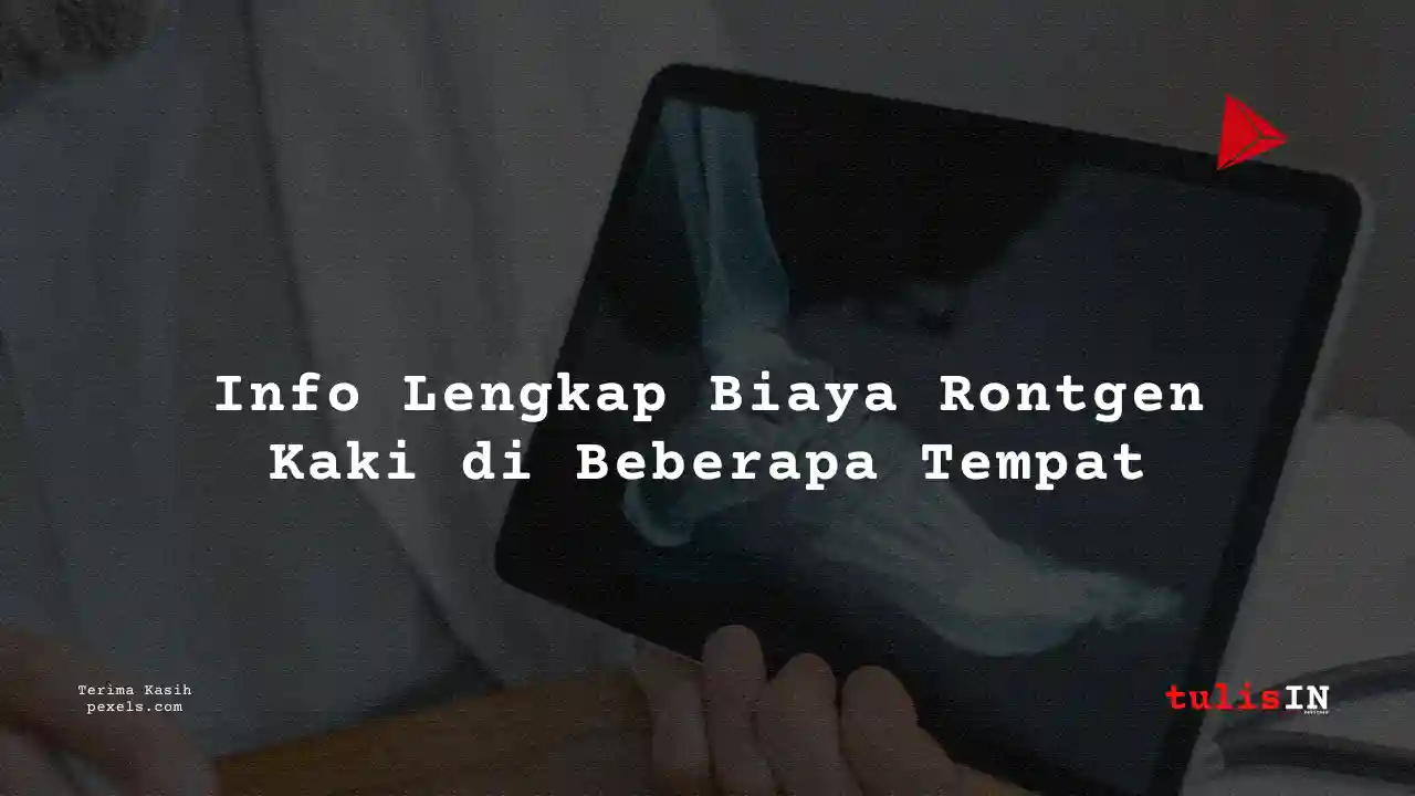 Berapa Harga Biaya Rontgen Kaki Laboratorium Klinik Kimia Farma Jakarta 2021?