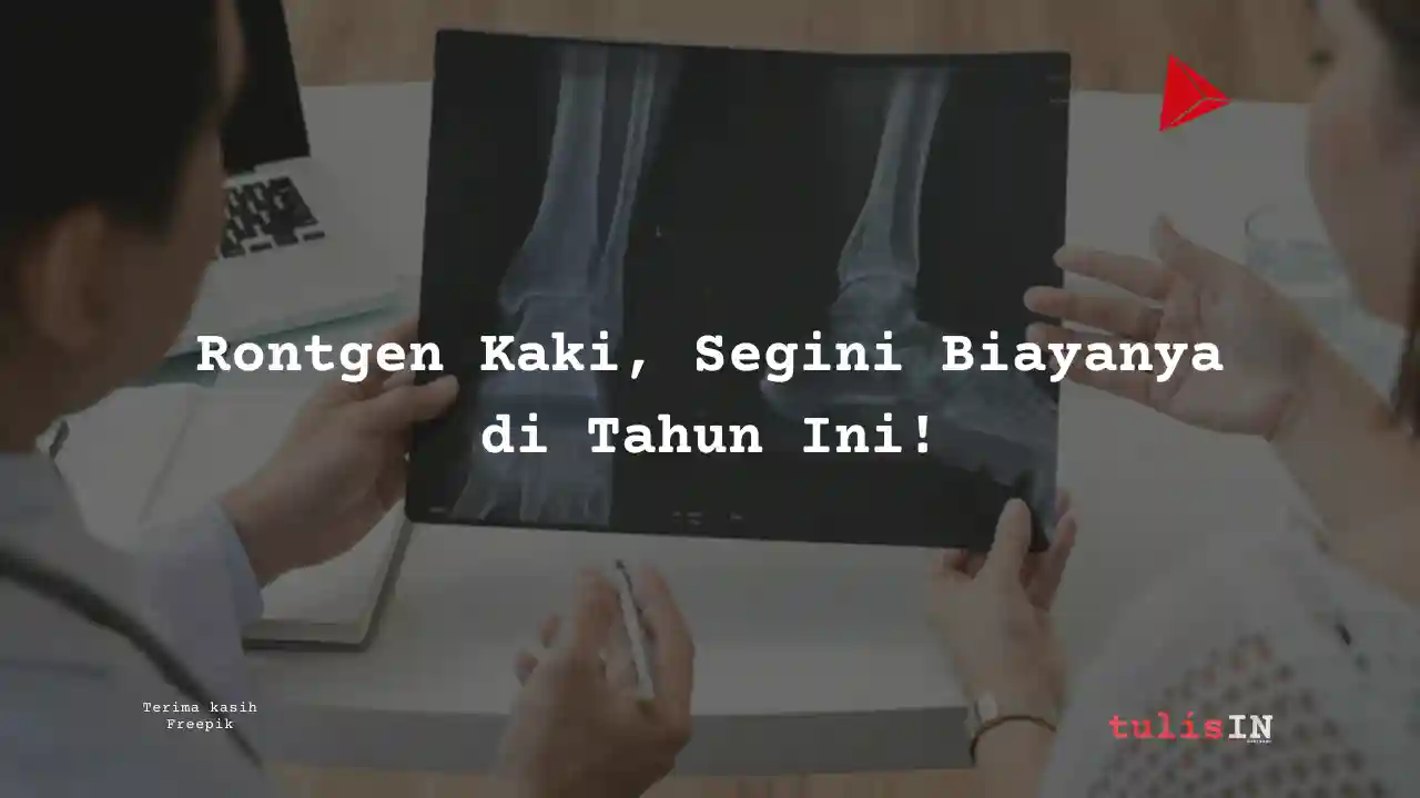 Berapa Biaya Rontgen Kaki Laboratorium Klinik Kimia Farma?