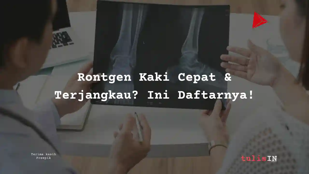 Berapa Biaya Rontgen Kaki Laboratorium Klinik Prodia?