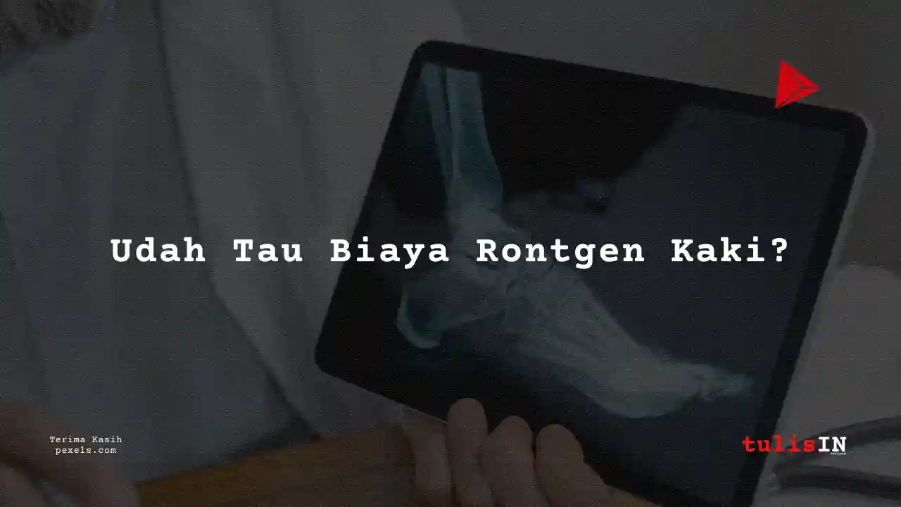 Berapa Harga Biaya Rontgen Kaki Puskesmas di Indonesia?