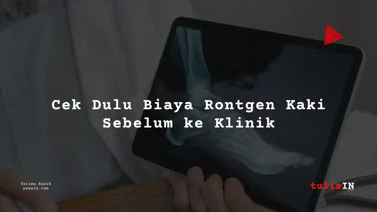 Berapa Harga Biaya Rontgen Kaki RS H. Adam Malik Medan 2021?