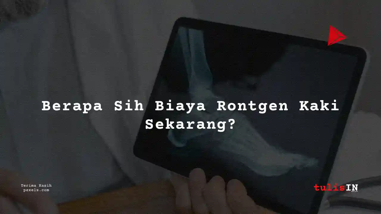Berapa Harga Biaya Rontgen Kaki RSUD Kota Banjar Banjar 2021?