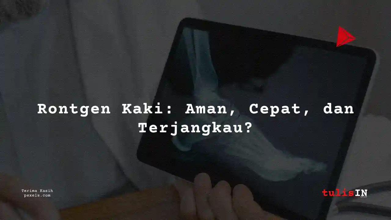 Berapa Harga Biaya Rontgen Kaki Siloam Hospitals TB Simatupang Jakarta 2021?