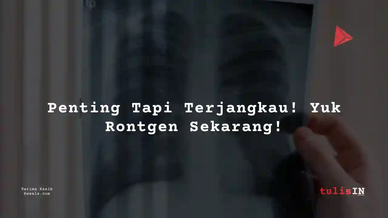 Berapa Harga Rontgen Dada RS Hj Bunda Halimah 2023?