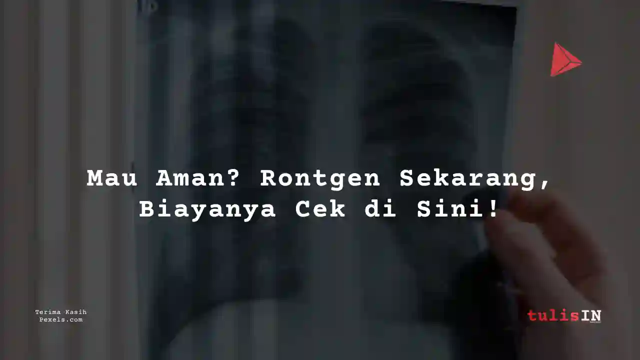 Berapa Harga Rontgen Dada RSU Bunda Margonda 2023?