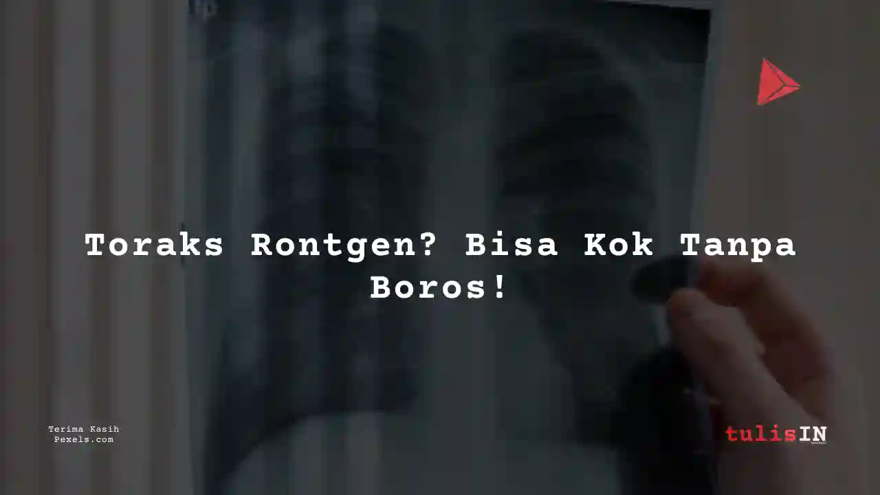 Berapa Harga Rontgen Dada Rumah Sakit Kartini 2023?
