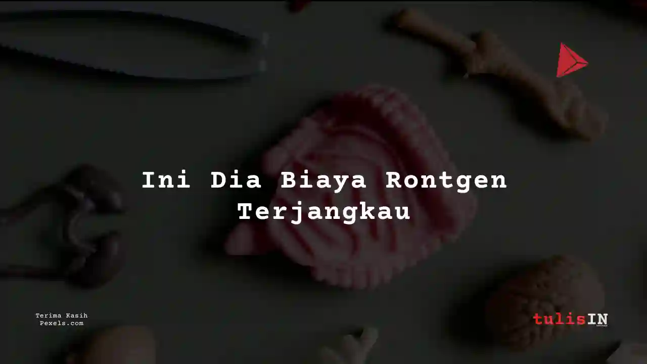 Berapa Harga Rontgen Perut atau Lambung Siloam Hospitals Bogor 2023?